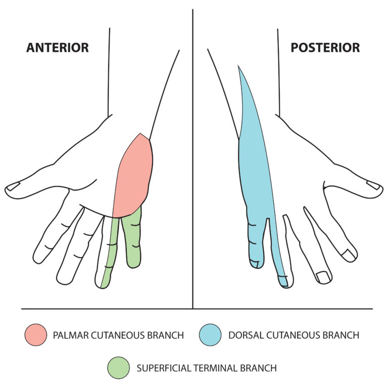 Upper Limb Nerve Lesions Part The Ulnar Nerve Medical Exam Prep