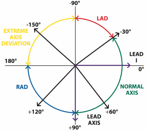 The Basics of ECG Interpretation (Part 2 – Rate, Rhythm and Axis Sns-Brigh10