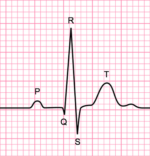 The Basics of ECG Interpretation (Part 2 – Rate, Rhythm and Axis ...