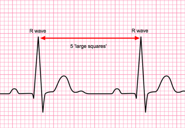 Rate calculation - Medical Exam Prep