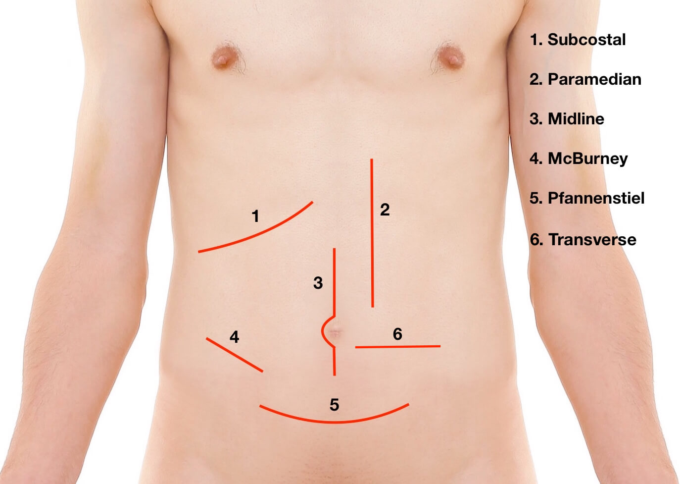 Langer s Lines And Surgical Incisions Medical Exam Prep