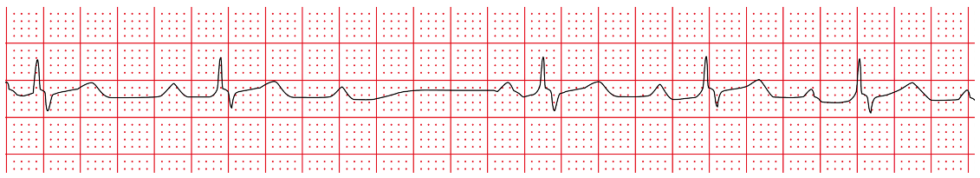 Test Your ECG Knowledge – Rate, Rhythm & Axis - Medical Exam Prep